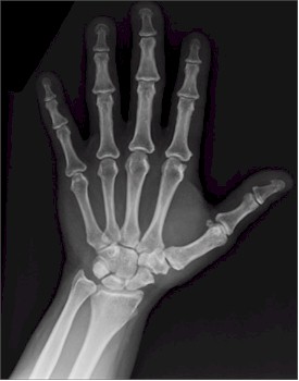 x-rays | Try Zeolite